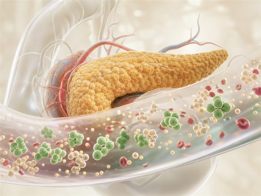 Medical visualization of diabetes