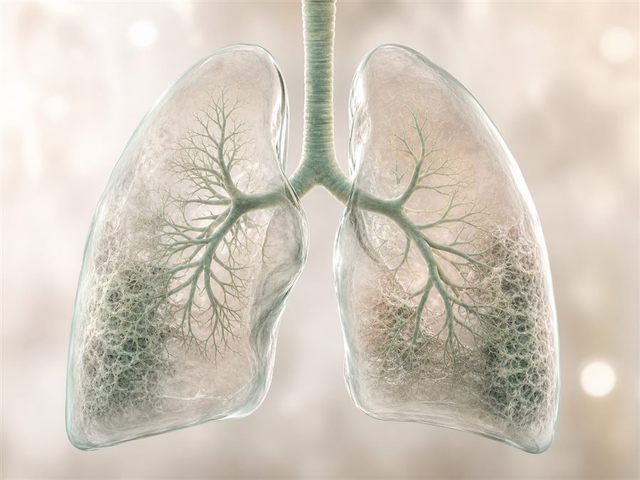 Medical visualization of pulmonary fibrosis